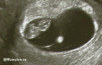 8 nedelja trudnoce ultrazvuk