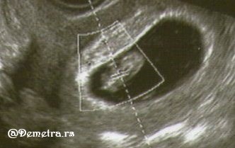 9 nedelja trudnoce ultrazvuk