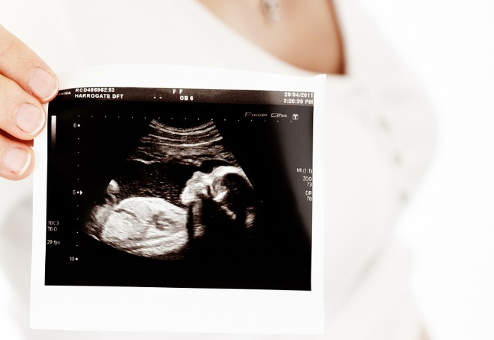 tezina i duzina bebe po nedeljama trudnoce